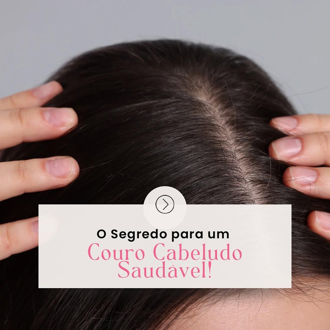 Imagem educativa sobre couro cabeludo saudável