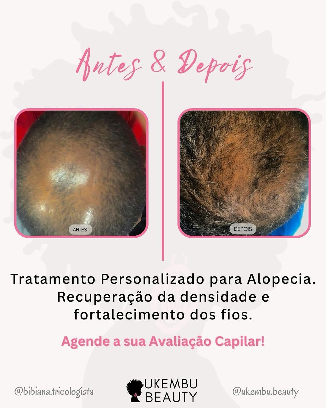 Mais densidade com acompanhamento e rotina ajustada